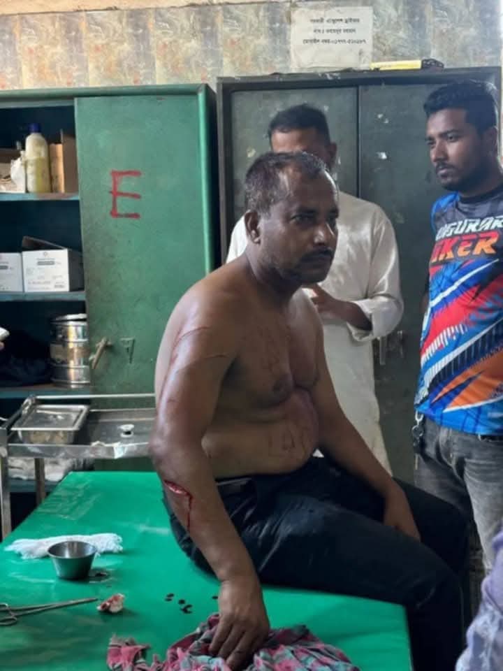 মাগুরায় সাবেক কাউন্সিলরের উপর সন্ত্রাসী হামলা