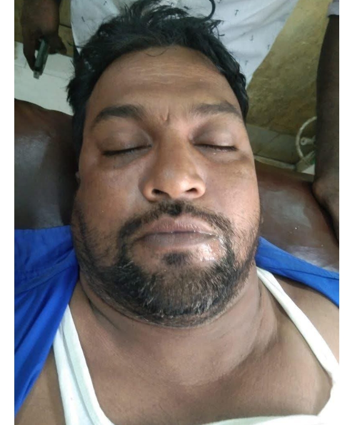 ব্রাক্ষণবাড়িয়া আখাউড়া পল্লী বিদ্যুৎ জোনাল অফিসের লাইন টেকনিশিয়ান বিদ্যুতায়িত হয়ে নিহত।