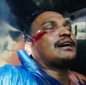 চাঁপাইনবাবগঞ্জে সন্ত্রাসী হামলার স্বিকার আরিফ নামে এক যুবক