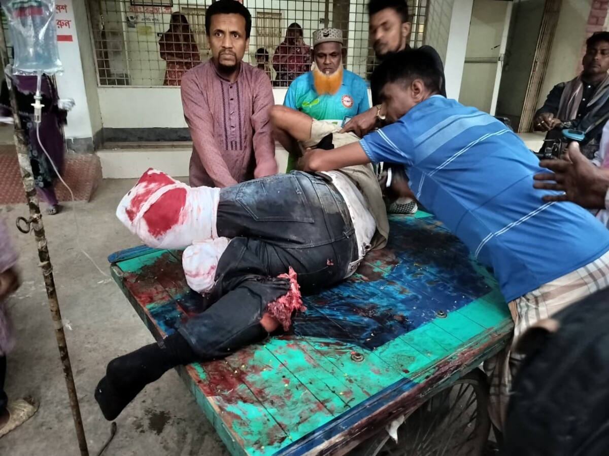 আত্রাইয়ে চলন্ত ট্রেন থেকে নামতে গিয়ে  পুলিশ সদস্যের দুই পা বিচ্ছিন্ন