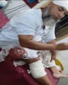 কুষ্টিয়ায় পাওনা টাকা চাওয়াকে কেন্দ্র করে পল্লী চিকিৎসকসহ দুজনকে কুপিয়ে জখম