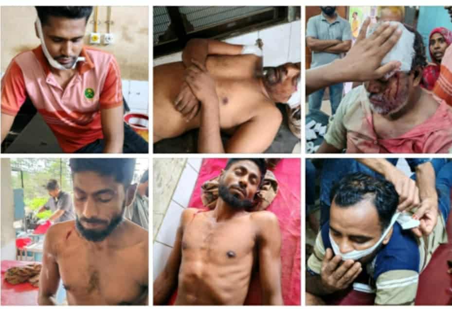 কুষ্টিয়া অধিপত্যের জেরে দুই পক্ষের সংঘর্ষে, আহত ৩০