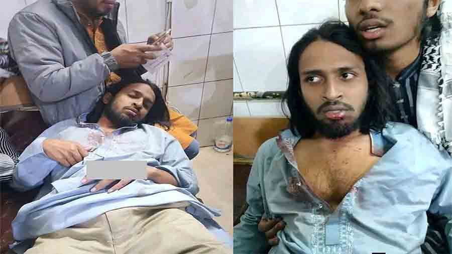 ছাত্রলীগ কর্মীদের হাতে মার খাননি দাবি করে আম্মার- ‘আমরা মাইর খাইনি, মাইর দিয়েছি’