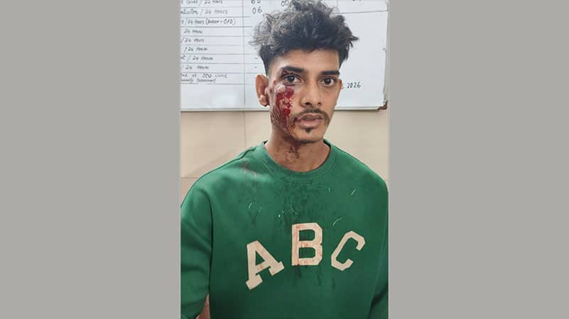 হাটহাজারীতে প্রকাশ্য দিবালোকে গুলি বর্ষণ: আহত-১, এলাকায় চরম আতঙ্ক